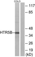 SR-5B Polyclonal Antibody