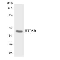 SR-5B Polyclonal Antibody