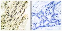 SRF Polyclonal Antibody