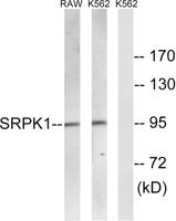 SRPK1 Polyclonal Antibody