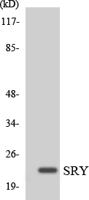 SRY Polyclonal Antibody