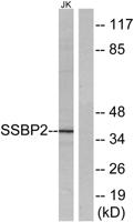 SSBP2 Polyclonal Antibody