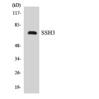 SSH3 Polyclonal Antibody