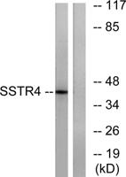 SSTR4 Polyclonal Antibody