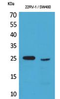 SSX Polyclonal Antibody