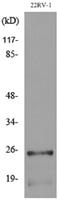 SSX Polyclonal Antibody