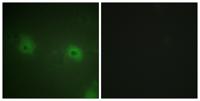 STAM2 Polyclonal Antibody