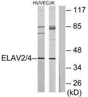 HuB/D Polyclonal Antibody