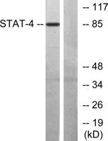 Stat4 Polyclonal Antibody