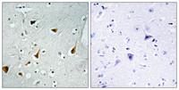 Stat6 Polyclonal Antibody