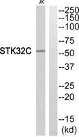 STK32C Polyclonal Antibody