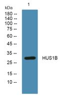 HUS1B Polyclonal Antibody