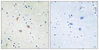 Akt2 Polyclonal Antibody