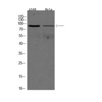 ADAM9 Polyclonal Antibody