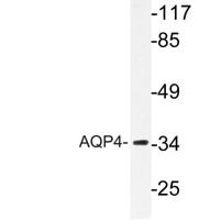 AQP4 Polyclonal Antibody