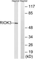 SUDD Polyclonal Antibody