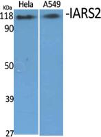 IARS2 Polyclonal Antibody