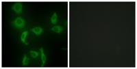 IARS2 Polyclonal Antibody