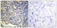 ICAD Polyclonal Antibody