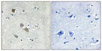 IFI-56K Polyclonal Antibody