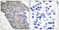 Synaptotagmin Polyclonal Antibody