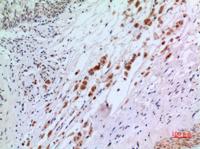 IFN-αR2 Polyclonal Antibody