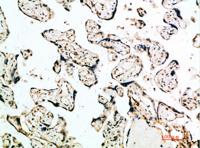 IFN-β Polyclonal Antibody