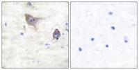 Synuclein-β Polyclonal Antibody