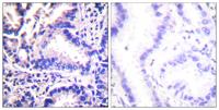 Synuclein-γ Polyclonal Antibody