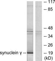 Synuclein-γ Polyclonal Antibody