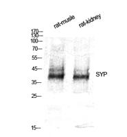 SYP Polyclonal Antibody