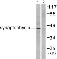 SYP Polyclonal Antibody