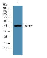 SYT2 Polyclonal Antibody