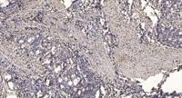 T2R10 Polyclonal Antibody