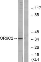 Olfactory receptor 6C2 Polyclonal Antibody