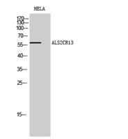 ALS2CR13 Polyclonal Antibody