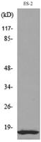 IL-1β Polyclonal Antibody