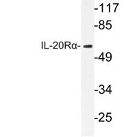 IL-20Rα Polyclonal Antibody