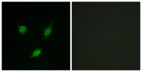 TACC1 Polyclonal Antibody