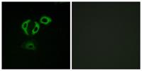 TACC3 Polyclonal Antibody