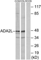 TADA2L Polyclonal Antibody