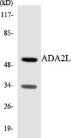 TADA2L Polyclonal Antibody