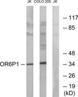 Olfactory receptor 6P1 Polyclonal Antibody