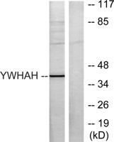 14-3-3 η Polyclonal Antibody