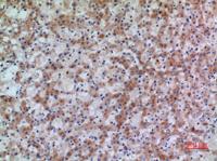 17β-HSD4 Polyclonal Antibody