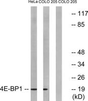 4E-BP1 Polyclonal Antibody