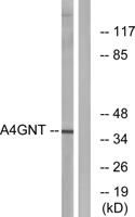 α4Gn-T Polyclonal Antibody