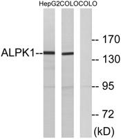 α-protein Kinase 1 Polyclonal Antibody