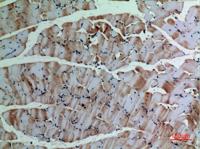 α-SMA Polyclonal Antibody