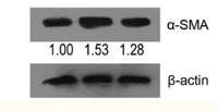 α-SMA Polyclonal Antibody